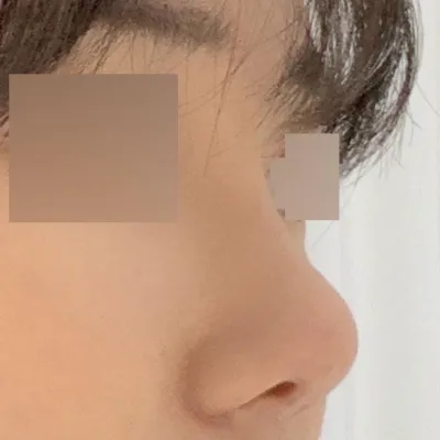 みんな自然できれいに高くなったって、どこでやったのか聞かれます~~~