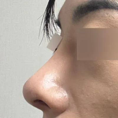 再手術を悩んでいる方はシム院長にぜひ行ってみてください