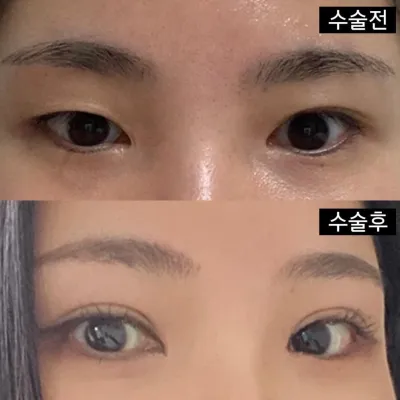 二重手術、目の再手術ならぜひ訪問をおすすめします