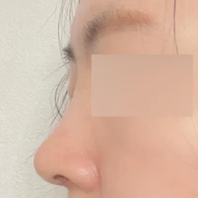 とても綺麗になってすっぴんにも自信が持てるようになりました