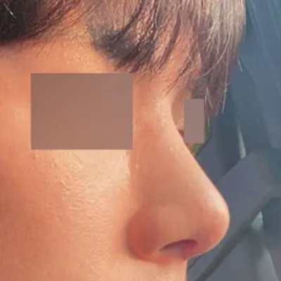 シャープな状態が維持されると言われたので期待しています