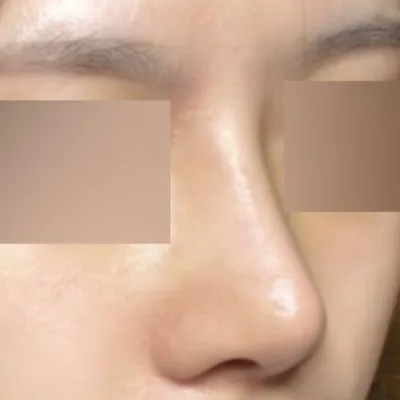 初めての手術だけど成功した感じがすごくしますね