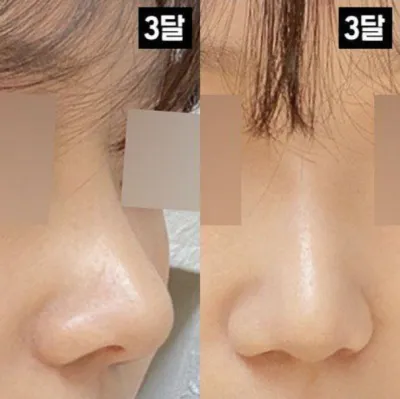 鼻筋も鼻先も全部気に入っています！