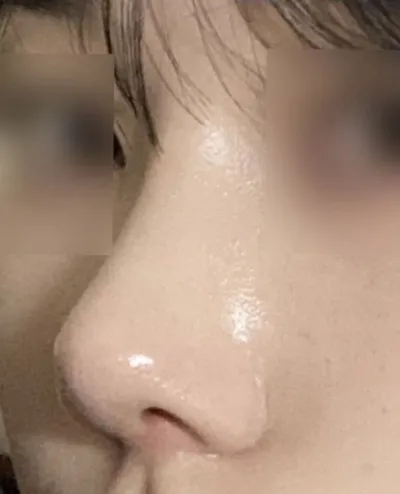 顔の比率に合った鼻を考慮してくれる点が特に良かったです。