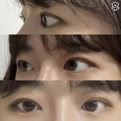 欲張らずに院長先生にお願いしようと思いました（笑）