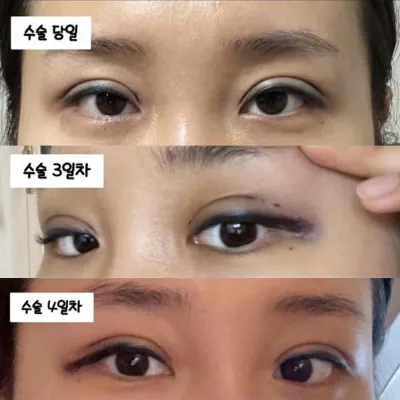 カウンセリングで無理のないように見てくれる、最高