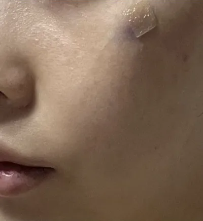 自然に気になっていた部分が改善された感じです!