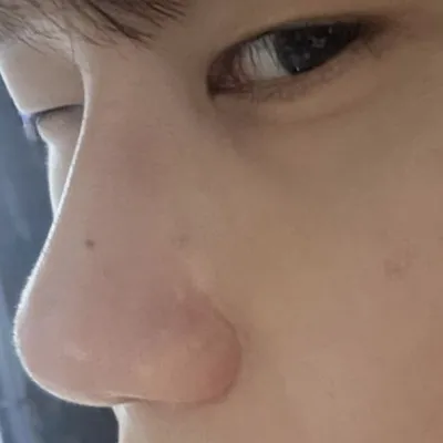 手術して良かったと思います。ありがとうございます。