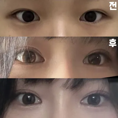 満足のいく結果でとても幸せです。院長先生ありがとうございます!!