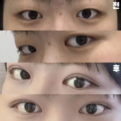 痛くないように繊細にしてくださってありがとうございました。