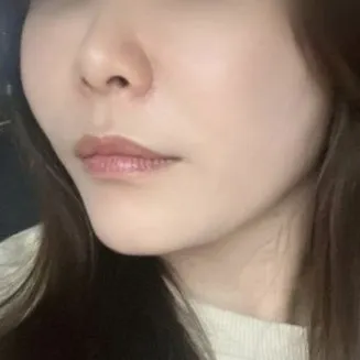 ピーチリフティングだけやったのに顔がピンと引き締まりました ㅎ