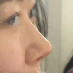 今、満足度が非常に高く、いつも鏡を見て感心しています...