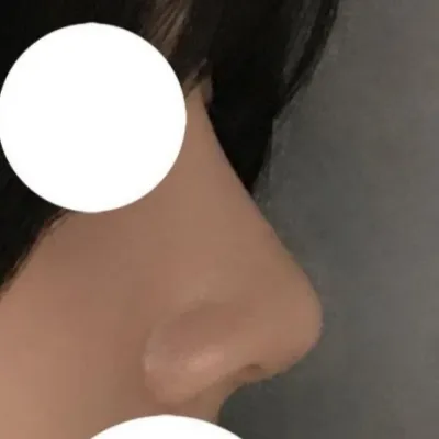 写真撮影の時も鼻筋がとても気に入っています！