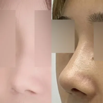 手術後、自信がつきました