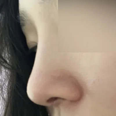 ウィーバースのシム・ジョンファン院長に7月初めに手術を受けました！