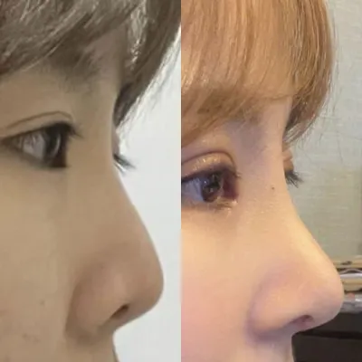 鼻再手術はソ院長、目再手術はシム院長にお願いしました