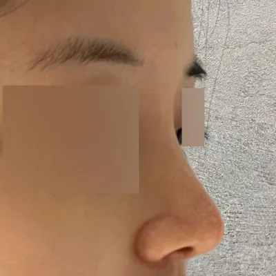 手術してからもう2ヶ月になりました